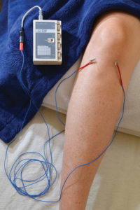 Fig. 8 Electrical stimulation